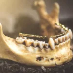 500-Year-Old Gold Dental Bridge Found in Scotland
