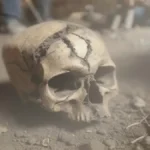 Healed Skull Wounds Rewrite Medieval Violence History